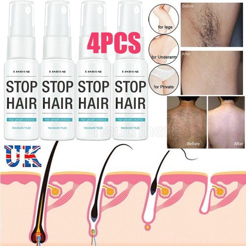 Permanent hair removal - 4x,